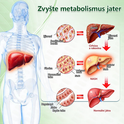 🎁 Zbývá pouze 5 balení! Využijte extra 50% slevu ještě dnes! Dopřejte si to nejlepší. Nepropásněte tuto jedinečnou nabídku – další šance už nebude.