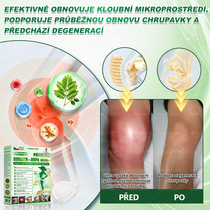 🎁 Zbývá pouze 5 balení! Využijte extra 50% slevu ještě dnes! Dopřejte si to nejlepší. Nepropásněte tuto jedinečnou nabídku – další šance už nebude.