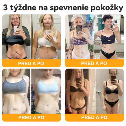 Izdelano in odposlano iz Slovenije 🏆 PUROSA® Krema z čebeljim strupom za obnovo kože  ⏰ ZADNJI DAN – 80 % POPUST!