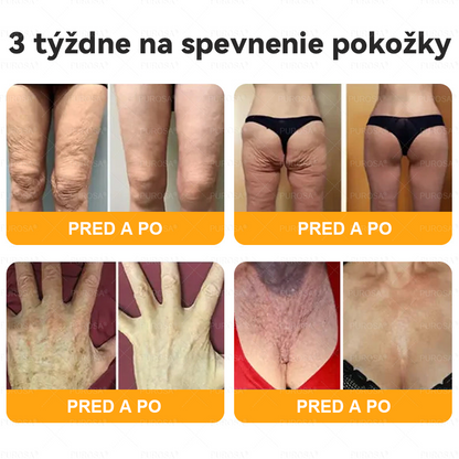 Izdelano in odposlano iz Slovenije 🏆 PUROSA® Krema z čebeljim strupom za obnovo kože  ⏰ ZADNJI DAN – 80 % POPUST!