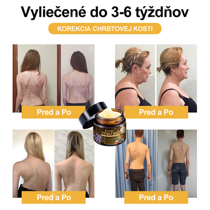 Oficiální obchod: 🦵 XRLXRL® okamžitý ultra silný krém s včelím jedem proti bolesti – (Zklidňuje bolest při artritidě, bolesti svalů, zad, kolen, ramen, kyčlí, zápěstí a rukou)