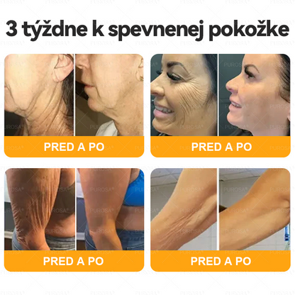 Izdelano in odposlano iz Slovenije 🏆 PUROSA® Krema z čebeljim strupom za obnovo kože  ⏰ ZADNJI DAN – 80 % POPUST!