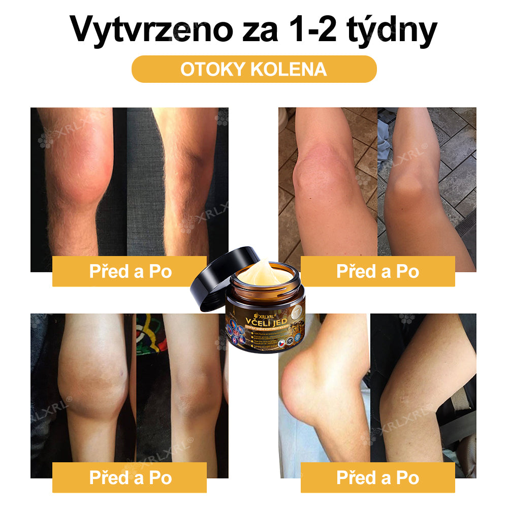 Oficiální obchod: 🦵 XRLXRL® okamžitý ultra silný krém s včelím jedem proti bolesti – (Zklidňuje bolest při artritidě, bolesti svalů, zad, kolen, ramen, kyčlí, zápěstí a rukou)