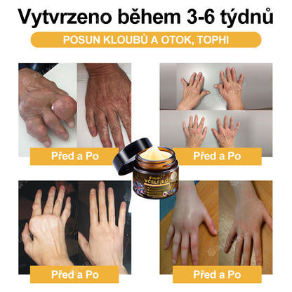 Oficiální obchod: 🦵 XRLXRL® okamžitý ultra silný krém s včelím jedem proti bolesti – (Zklidňuje bolest při artritidě, bolesti svalů, zad, kolen, ramen, kyčlí, zápěstí a rukou)