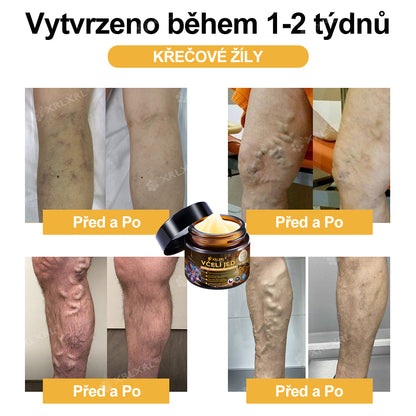 Oficiální obchod: 🦵 XRLXRL® okamžitý ultra silný krém s včelím jedem proti bolesti – (Zklidňuje bolest při artritidě, bolesti svalů, zad, kolen, ramen, kyčlí, zápěstí a rukou)